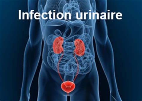 Pourquoi jai une infection urinaire après chaque rapport sexuel